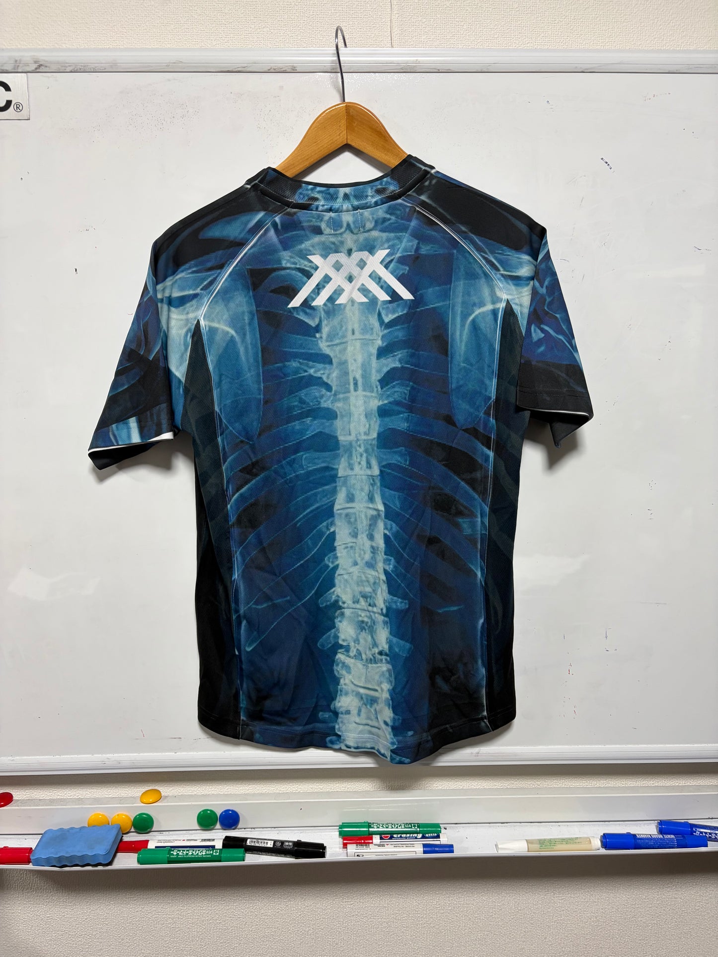 【撮影サンプル】 X-Ray