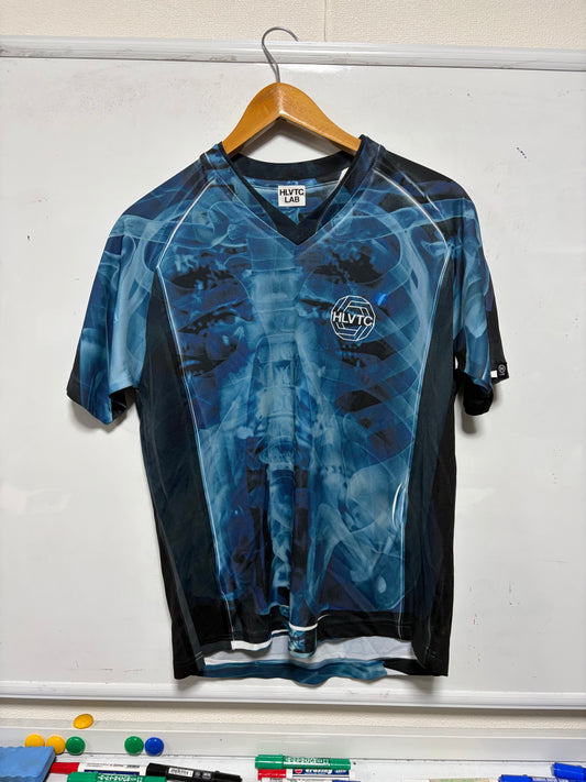 【撮影サンプル】　X-Ray